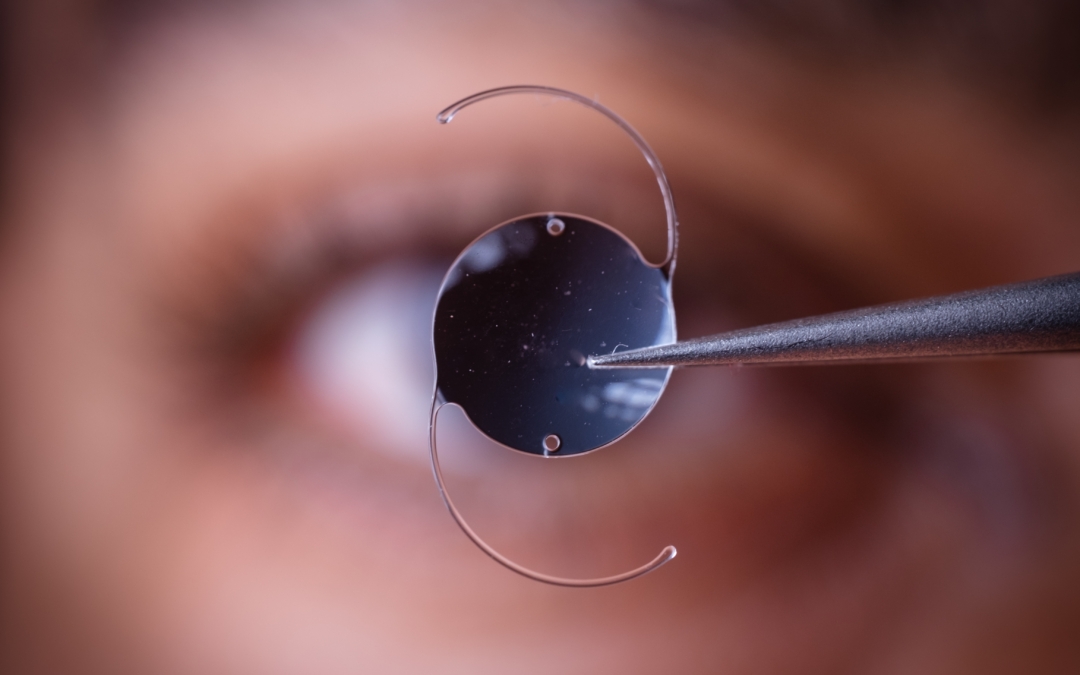 Why You Need A Lens Implant (IOL) With Cataract Surgery