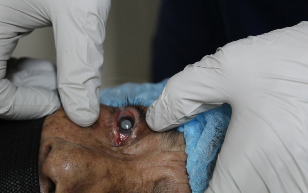 Restoring Sight to Those in Need
